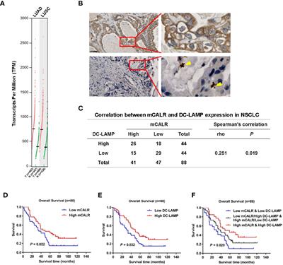 CALR-TLR4 Complex Inhibits Non-Small Cell Lung Cancer Progression by Regulating the Migration and Maturation of Dendritic Cells